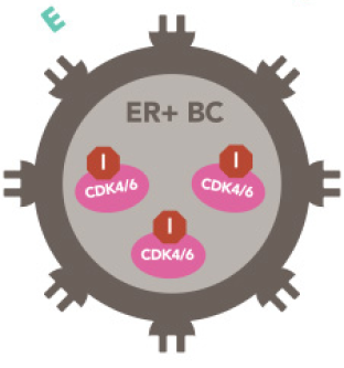 Illustration of how ZOLADEX reduces estrogen made by the ovaries and aromatase inhibitors reduce estrogen made by other tissues